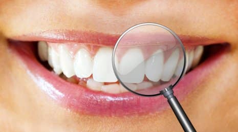 Saubere Zahnzwischenräume mit der Munddusche